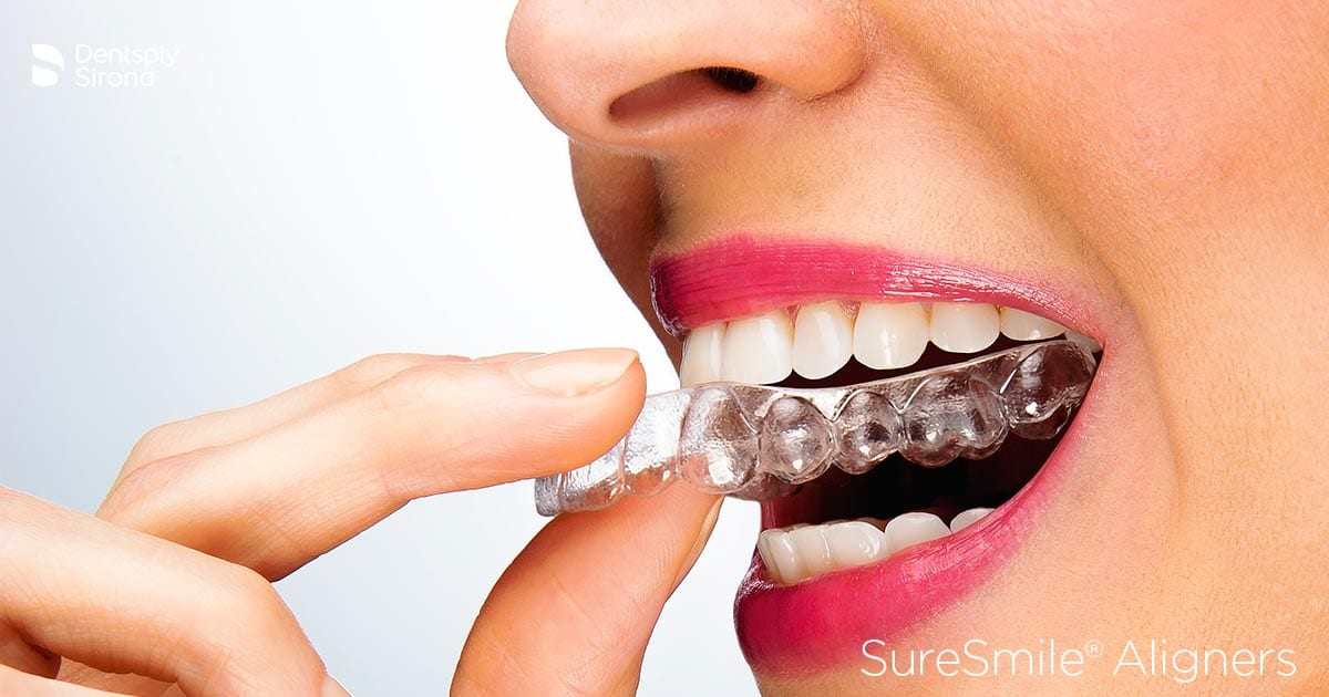 Clear teeth aligners from Oasis Dental