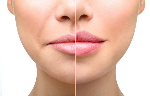 Part,Of,Face,,Young,Woman,Close,Up.,Sexy,Plump,Lips
